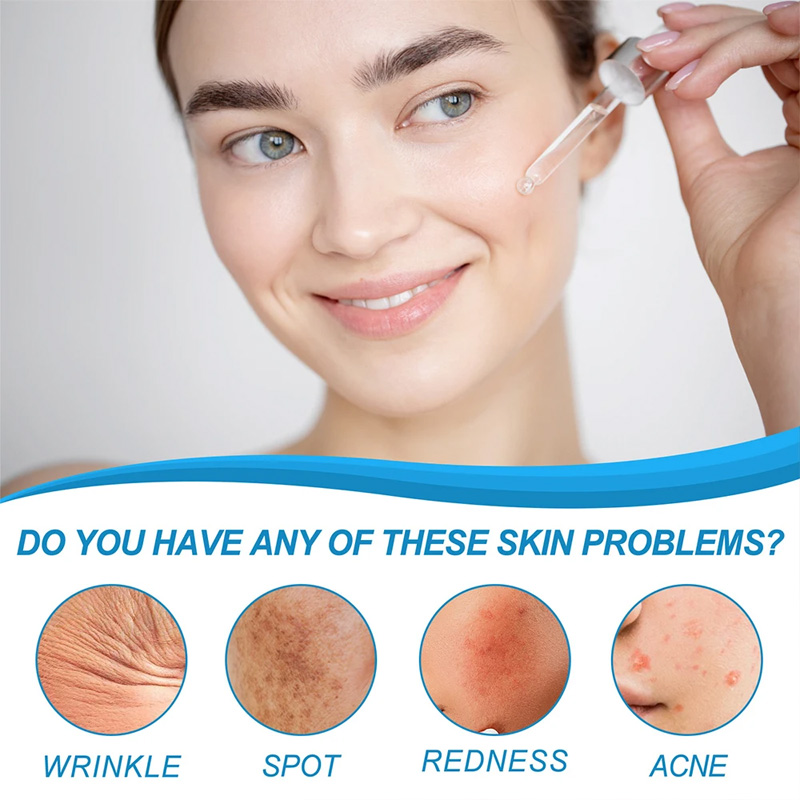 1/3/5 sztuk B5 zkurczające por – Skincare La Roche Posay recenzja i cena
